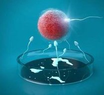 一代试管婴儿适应症有哪些