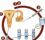 卓伟疑遭偷拍被曝泰国做试管婴儿，网友：出去混早晚要还