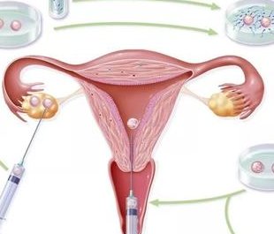 染色体易位在武汉大学中南医院可以做三代试管吗？染色体平衡易位还能生健康的宝宝吗？